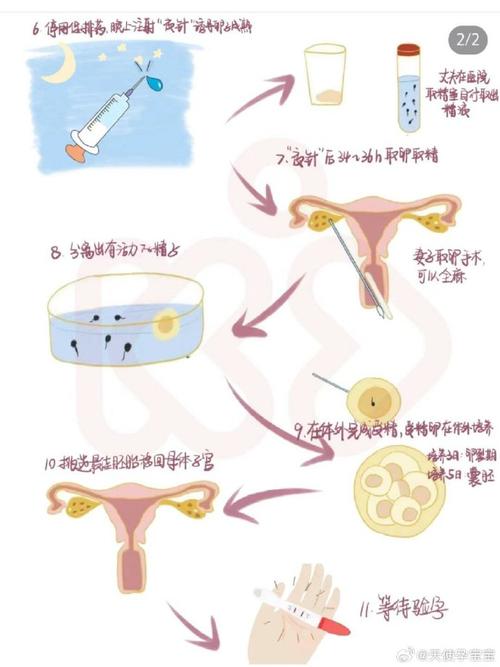 养襄试管技术