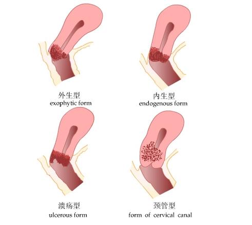 性行为出血