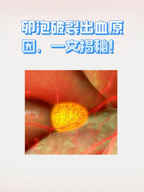 卵泡裂变