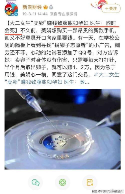  供卵服务