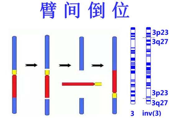 染色体倒臂试管技术