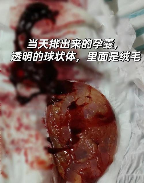 胚胎生化失败