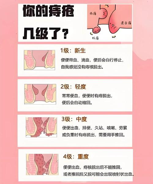 痣疮