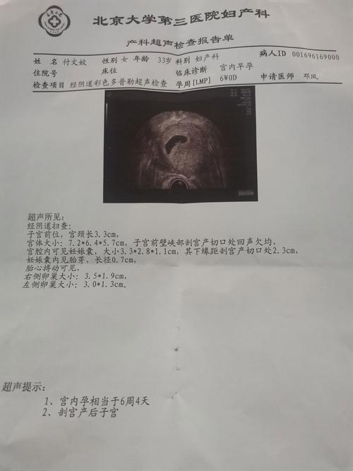 试管婴儿25天